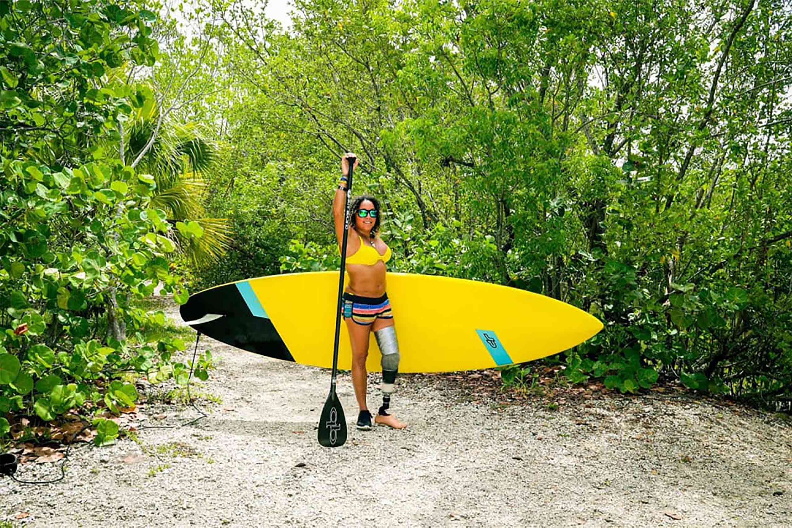 Paddle-boarder with a prosthetic leg in Florida, USA. Ocean travel offers accessible experiences and assistance to disabled travellers.