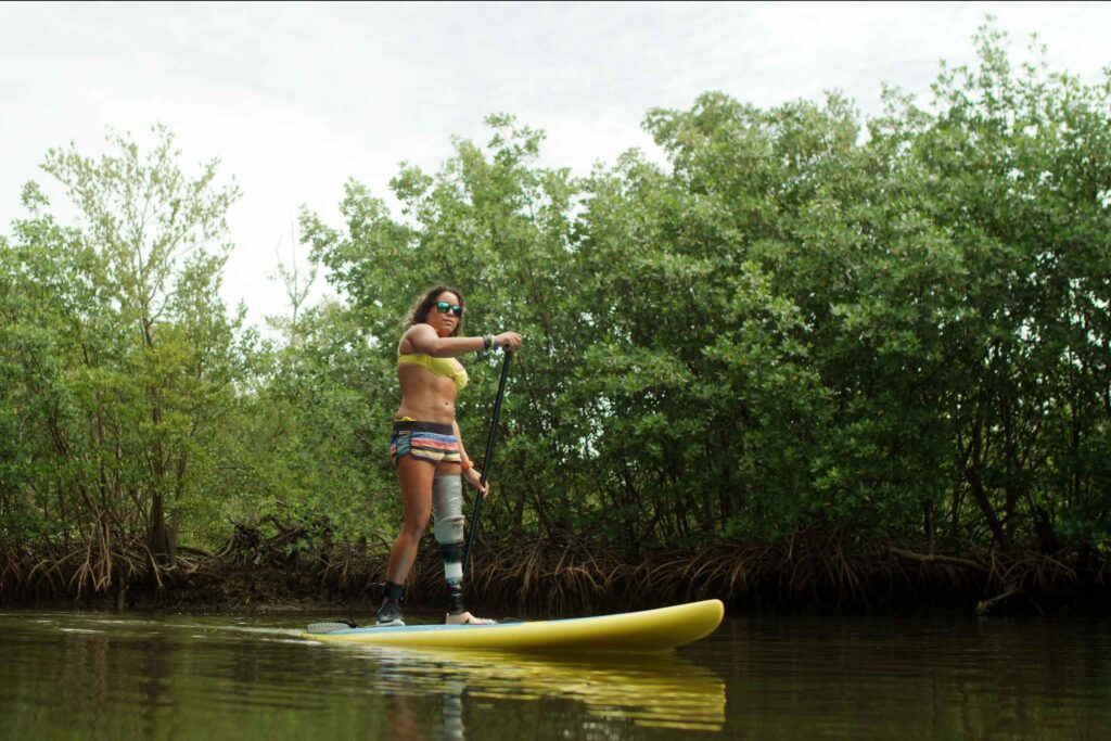 An amputated female paddle boarder enjoys a paddle boarding session in Oleta River State Park